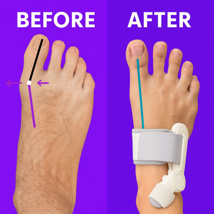 FlexiToe V2.0
